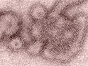 Flu shot offers modest protection this year in US; Canadian numbers likely lower | iNFOnews.ca Flu shot offers modest protection this year in US; Canadian numbers likely lower | iNFOnews.ca