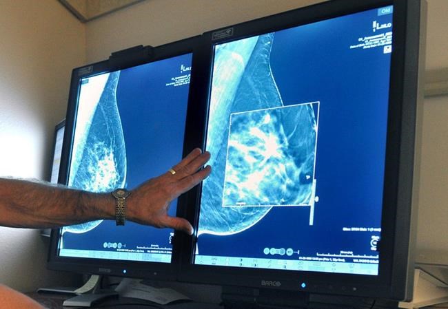 Earliest breast cancer riskier for young women, blacks, just like invasive disease, study says | iNFOnews.ca Earliest breast cancer riskier for young women, blacks, just like invasive disease, study says | iNFOnews.ca