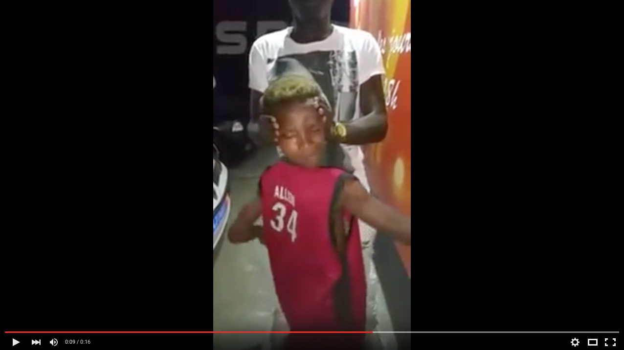 TRENDING NOW: Kid with extremely flexible neck | iNFOnews.ca