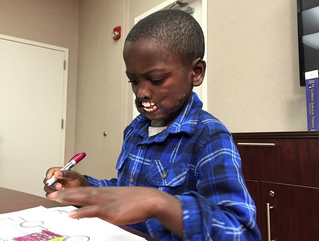 African boy mauled by chimps to undergo facial reconstruction surgery at New York hospital | iNFOnews.ca