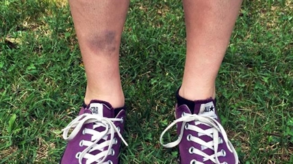 Players in hunt for Pokemon Go monsters feel real-world pain | iNFOnews.ca