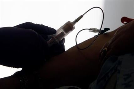 Blood test may help predict which breast cancers will recur | iNFOnews.ca