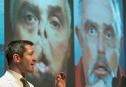 Quebec man doing well as doctors rejoice at first Canadian face transplant | iNFOnews.ca