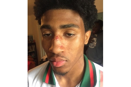 Lawyer calls for review into excessive force allegations from Halifax Police | iNFOnews.ca