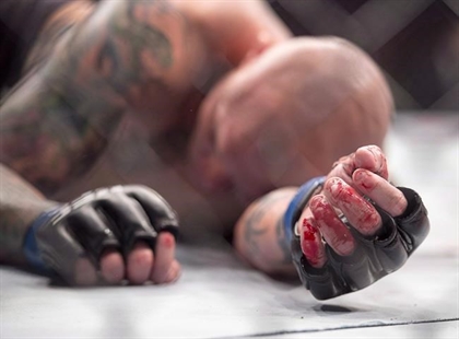 Ontario to change combat sport rules in bid to attract more events to province | iNFOnews.ca Ontario to change combat sport rules in bid to attract more events to province | iNFOnews.ca