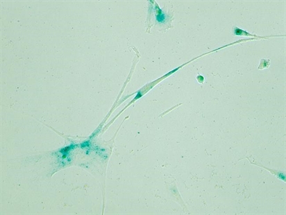 'Zombie cells' buildup in your body may play role in aging | iNFOnews.ca