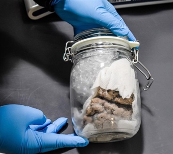 'Nothing surprises us anymore:' U.S. border officials find brain in package | iNFOnews.ca