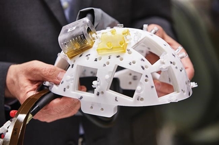 Multimillion-grant to speed innovative device for hard-to-treat brain disorders | iNFOnews.ca