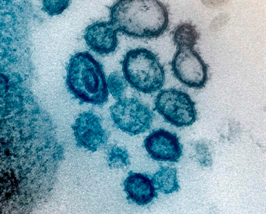 Behind the scenes, scientists prep for COVID-19 vaccine test | iNFOnews.ca Behind the scenes, scientists prep for COVID-19 vaccine test | iNFOnews.ca