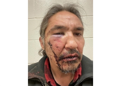 Charges dropped against Alberta First Nations chief violently arrested by RCMP | iNFOnews.ca