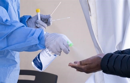 Isolation and sanitation during COVID-19 may affect human microbiome, scientists say | iNFOnews.ca