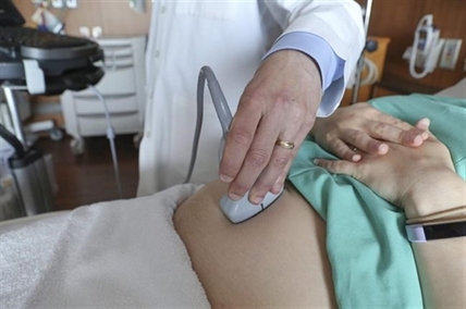 Study co-author says planned C-sections may be less risky for some moms and babies | iNFOnews.ca