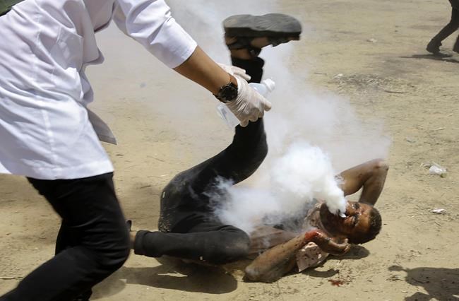 Gaza man's face badly damaged by Israeli tear gas canister | iNFOnews.ca Gaza man's face badly damaged by Israeli tear gas canister | iNFOnews.ca