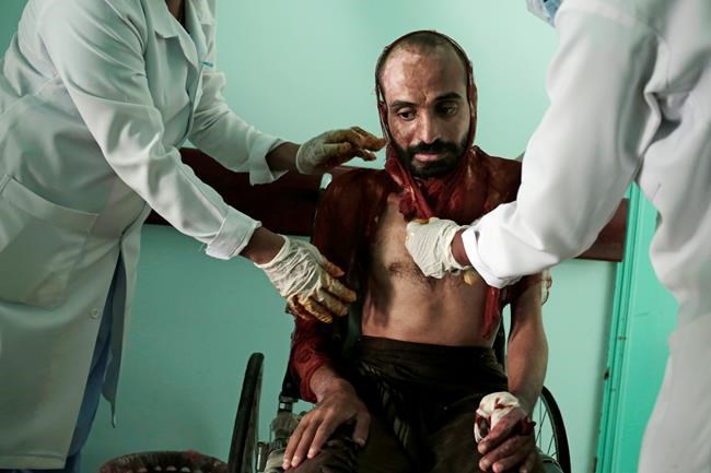 Ex-inmates: Torture rife in prisons run by Yemen rebels | iNFOnews.ca CP2145244144