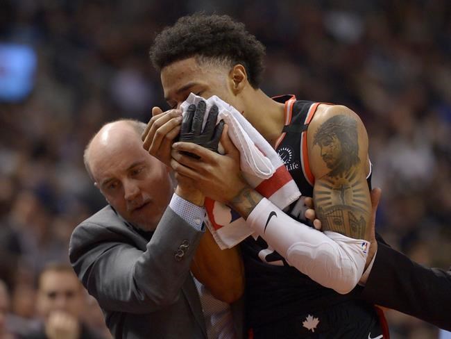 Patrick McCaw exits Raptors game early after being hit in face on rebound | iNFOnews.ca Patrick McCaw exits Raptors game early after being hit in face on rebound | iNFOnews.ca