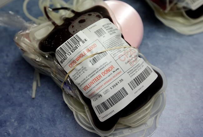 FDA expands Zika screening to all US blood centres | iNFOnews.ca FDA expands Zika screening to all US blood centres | iNFOnews.ca