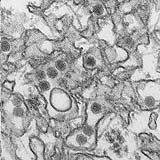 Woman found to spread Zika through sex for 1st time | iNFOnews.ca Woman found to spread Zika through sex for 1st time | iNFOnews.ca