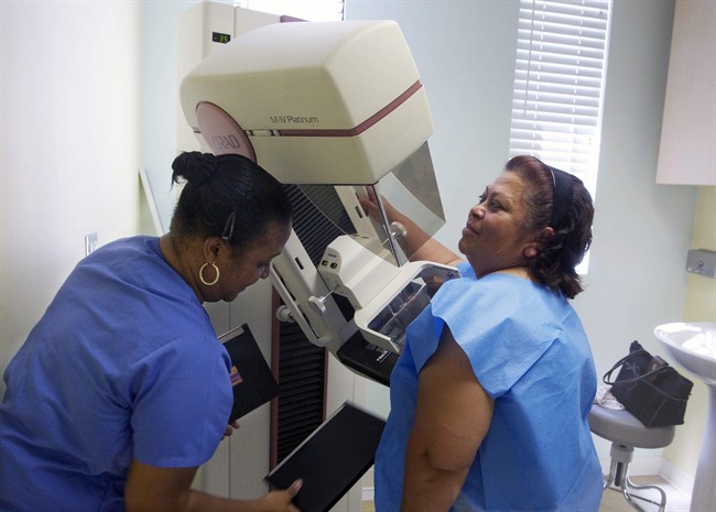 New expert panel finds mammograms most worth it for women 50-69; limited evidence before then | iNFOnews.ca CP33344638