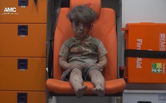 Brother of Syrian boy wounded in Aleppo dies | iNFOnews.ca