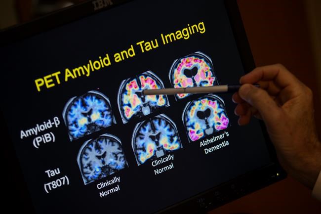 Senior's weakness for scams may be warning sign of dementia | iNFOnews.ca