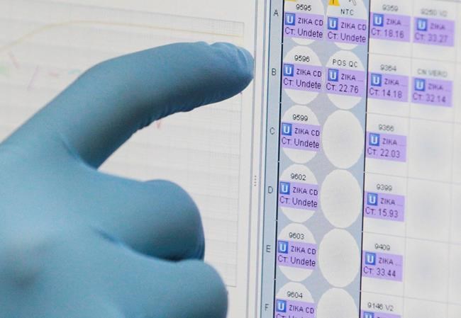 Urine test could simplify Zika virus detection | iNFOnews.ca