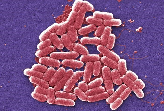 Report: 1st US case of germ resistant to last resort drug | iNFOnews.ca