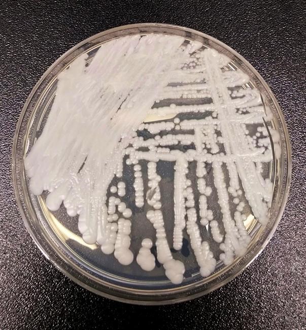 'Superbug' fungus new menace in US hospitals, mostly NY, NJ | iNFOnews.ca
