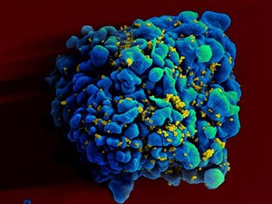 A monthly shot to prevent HIV infection? Monkey studies show big promise for novel drug | iNFOnews.ca CP27454649