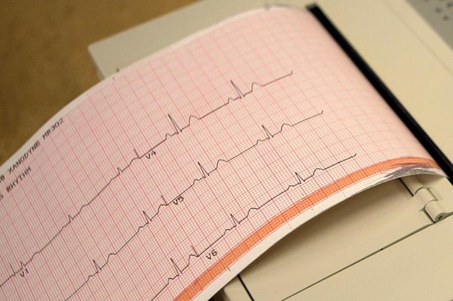 New, old drugs may offer fresh ways to fight heart disease | iNFOnews.ca New, old drugs may offer fresh ways to fight heart disease | iNFOnews.ca