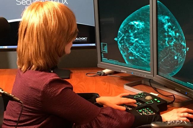 Are 3-D mammograms really better? US puts scans to the test | iNFOnews.ca