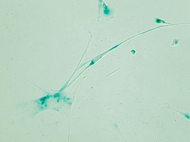 'Zombie cells' buildup in your body may play role in aging | iNFOnews.ca CP1668896166