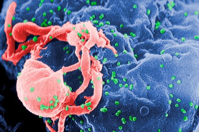 Study: For babies born with HIV, start treatment right away | iNFOnews.ca