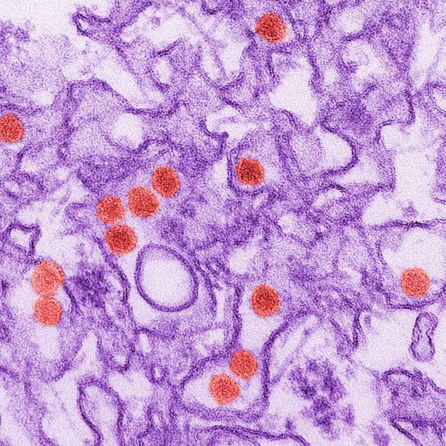 Risk of Zika infection through sex may last only a month | iNFOnews.ca CP1947339076