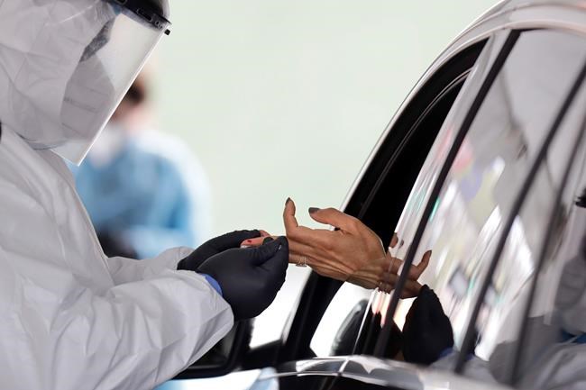 Answers to questions about new coronavirus antibody studies | iNFOnews.ca Answers to questions about new coronavirus antibody studies | iNFOnews.ca