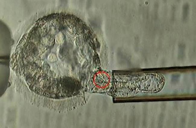 Parenting of the future: Many embryos, each with DNA profile | iNFOnews.ca