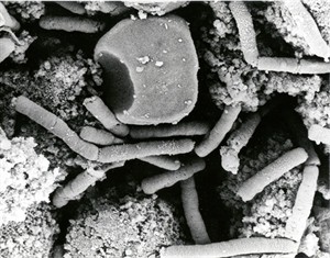 CDC probes possible anthrax exposure in a lab; 75 staffers monitored or given antibiotics | iNFOnews.ca CP28827402