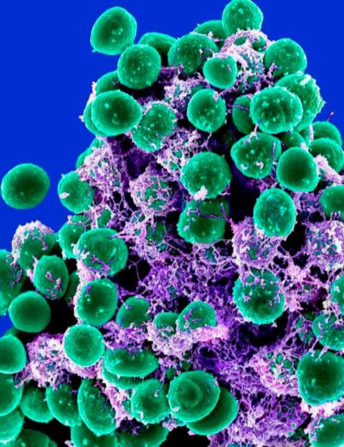 Tracking microbes people carry may predict future health | iNFOnews.ca Tracking microbes people carry may predict future health | iNFOnews.ca