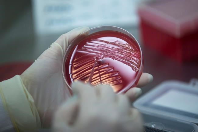 GOP health bill would cut CDC's $1B disease fighting fund | iNFOnews.ca