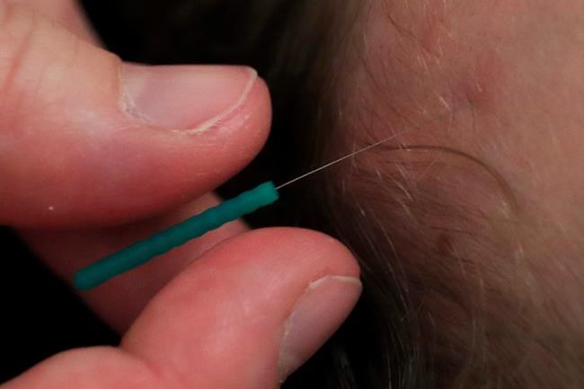 No stethoscope for pain: Scientists seek real way to measure | iNFOnews.ca No stethoscope for pain: Scientists seek real way to measure | iNFOnews.ca