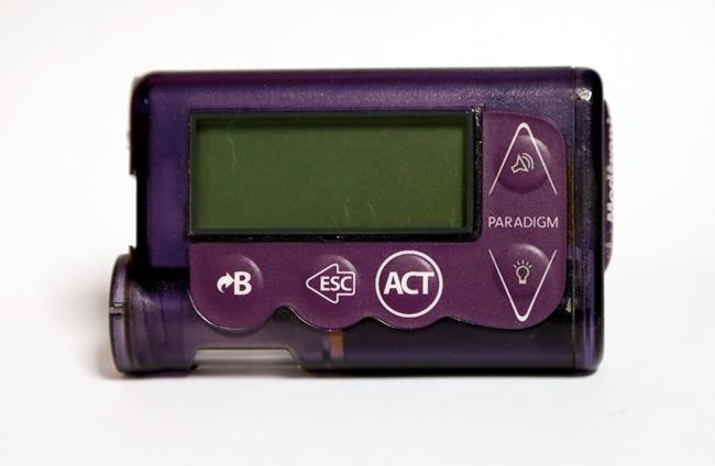 Insulin pumps have most reported problems in FDA database | iNFOnews.ca