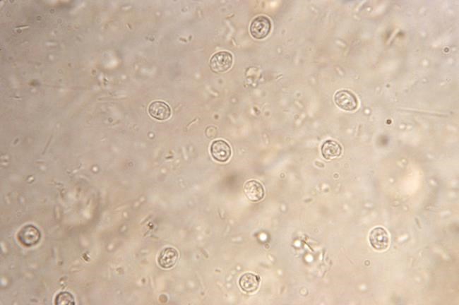 Health officials: Stay out of the pool if you have diarrhea | iNFOnews.ca Health officials: Stay out of the pool if you have diarrhea | iNFOnews.ca