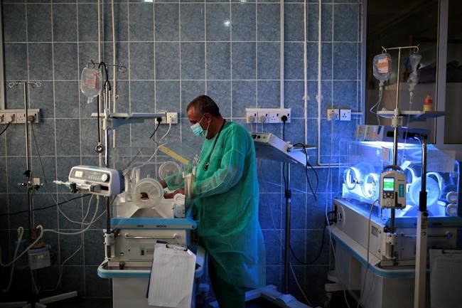 Virus-linked hunger tied to 10,000 child deaths each month | iNFOnews.ca