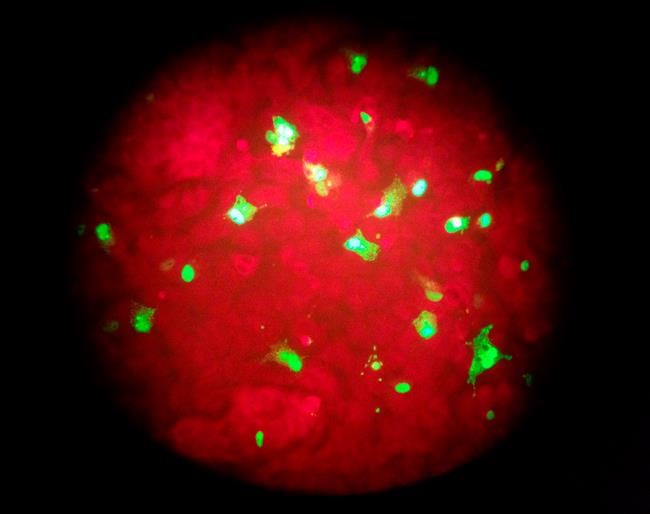 80,000 people died of flu last winter in US | iNFOnews.ca