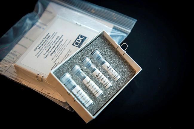 In scramble to stop virus, testing raises tough questions | iNFOnews.ca