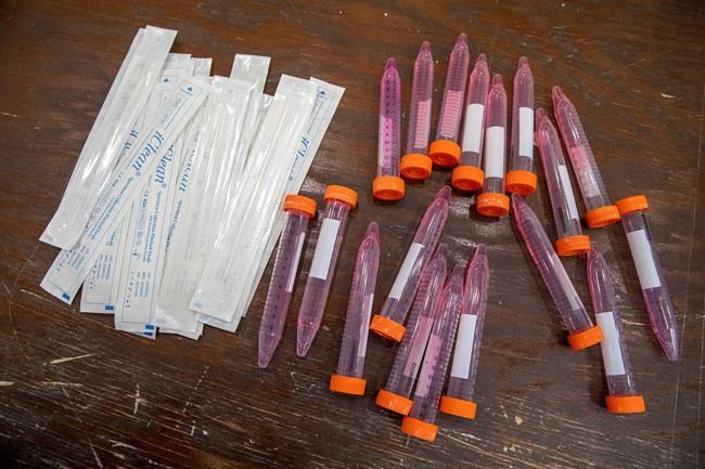 CDC, states' reporting of virus test data causes confusion | iNFOnews.ca CP1748953600