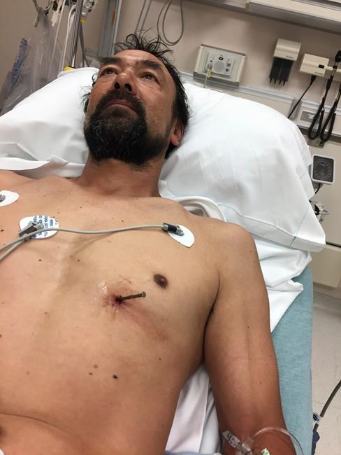 Man drives himself to hospital with nail in his heart | iNFOnews.ca