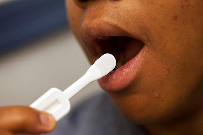 Mailing free home HIV tests helps detect more infections | iNFOnews.ca Mailing free home HIV tests helps detect more infections | iNFOnews.ca