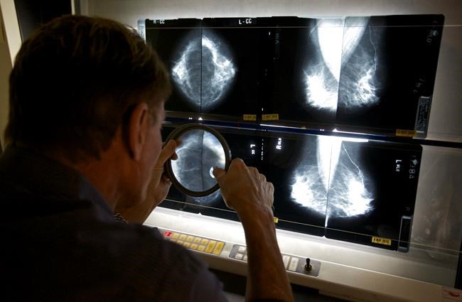 Breast cancer risk from menopause hormones may last decades | iNFOnews.ca