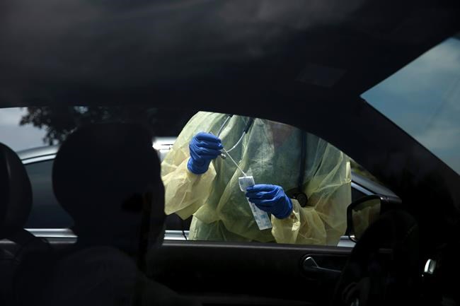 California officials report first virus death of a child | iNFOnews.ca