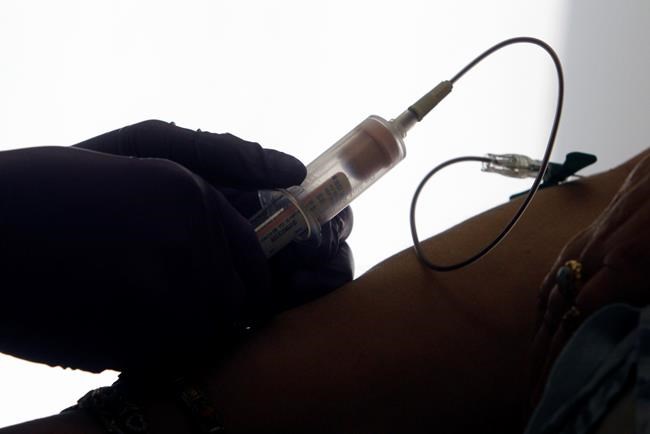 Study boosts hope of 'liquid biopsies' for cancer screening | iNFOnews.ca